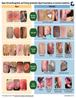 Mpox Clinical Recognition & Tes...