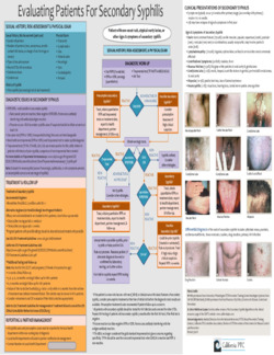 Evaluating Patients for Secondary S...